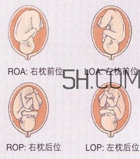 什么情况下需要剖腹产 剖腹产最全科普