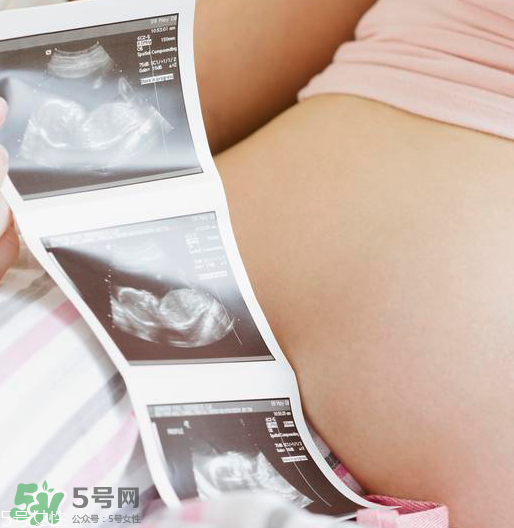 头胎双胞胎还能生二胎吗？双胞胎家庭能要二胎吗？