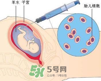 羊水栓塞是怎么回事？羊水栓塞怎么预防？