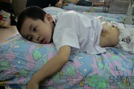 小孩可以拔罐吗？宝宝能拔火罐吗？