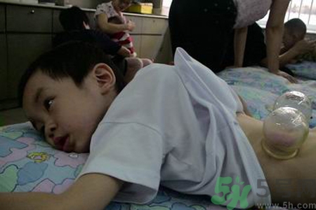 小孩可以拔罐吗？宝宝能拔火罐吗？
