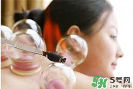 拔罐放血对身体好吗？拔罐放血有什么好处？
