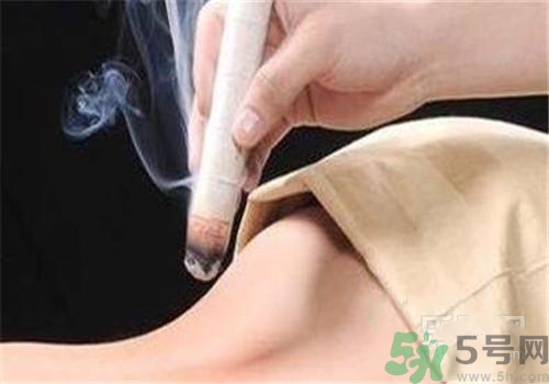 荨麻疹可以艾灸吗？荨麻疹艾灸哪个穴位？