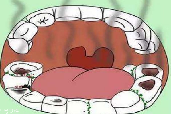 宝宝嘴巴里有臭鸡蛋味怎么办 口臭问题不能忽视