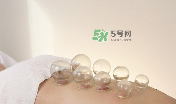 拔火罐是夏天好还是冬天好？什么时候拔火罐最合适？