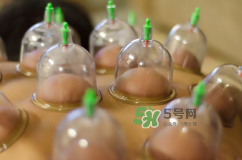 拔火罐是夏天好还是冬天好？什么时候拔火罐最合适？