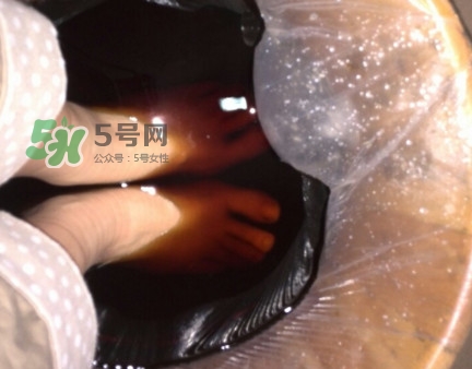 醋泡脚用白醋还是陈醋？泡脚用什么醋最好？