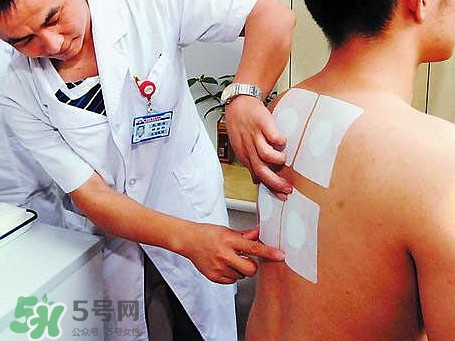 三伏灸可以治疗什么病？三伏灸与艾灸有什么区别