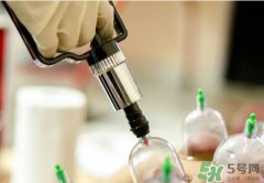 拔火罐可以祛痘吗?拔火罐怎么祛痘?