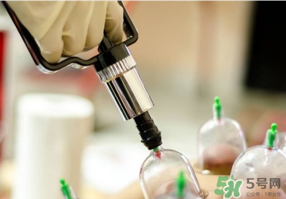 拔火罐可以祛痘吗?拔火罐怎么祛痘?