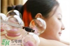 冬天拔火罐能减肥吗？拔火罐什么季节减肥效果最好？