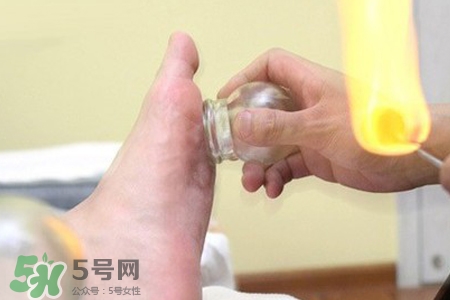 冬天拔火罐能减肥吗？拔火罐什么季节减肥效果最好？