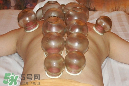 拔罐分季节吗？不同季节的拔罐禁忌