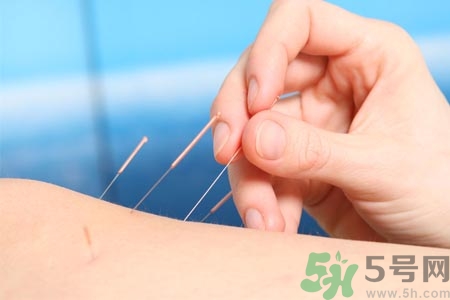 针灸一次要扎多长时间？针灸可以几天做一次？