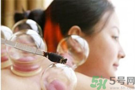 肩膀酸痛可以拔火罐吗？孕妇肩膀酸痛能拔火罐吗？