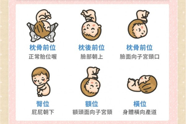 什么是胎位不正图片 胎位不正教你矫正 什么是胎位不正图片 胎位不正教你矫正