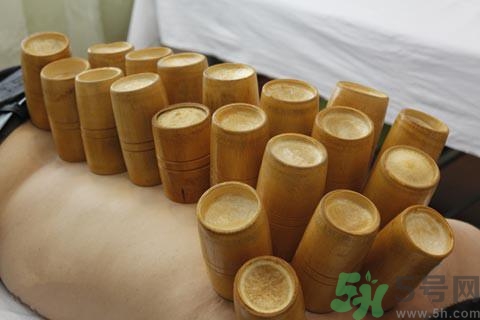 拔火罐后可以运动吗?拔罐后多久能运动?